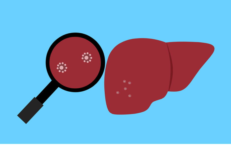 Hepatitis od A do E: Simptomi in zdravljenje