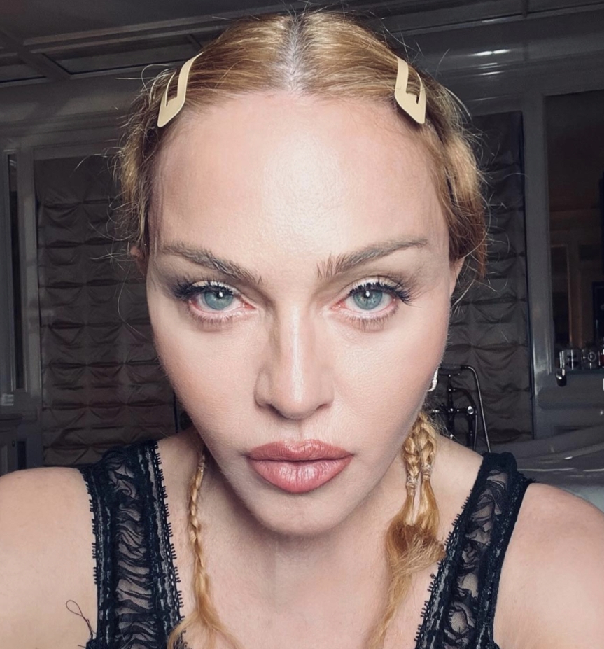 Madonna zaradi zdravstvenih težav odpovedala svetovno turnejo