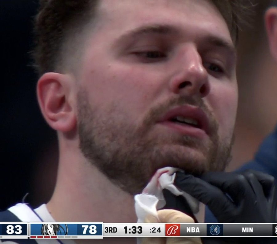 FOTO: Luka Dončić krvavel za novo zmago Dallasa, moral je na šivanje