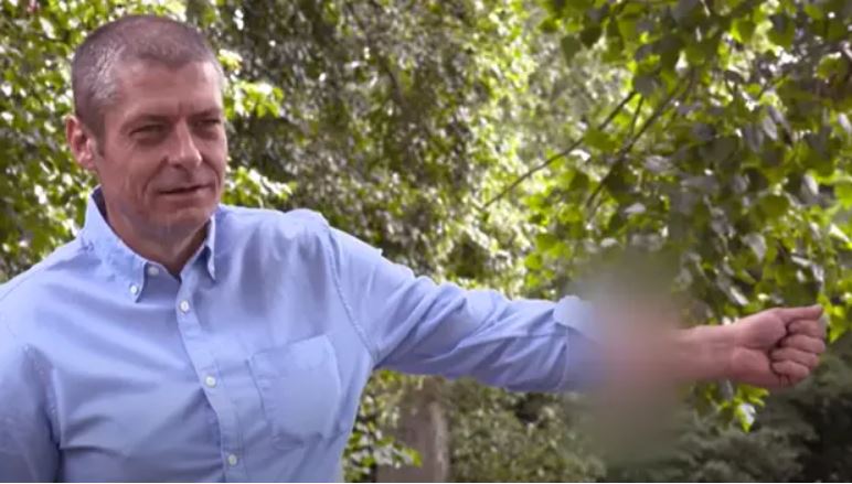 Šest let je živel s penisom na roki, nato pa so ga končno presadili na pravo mesto