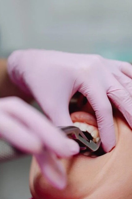 Implantat in predpriprave.