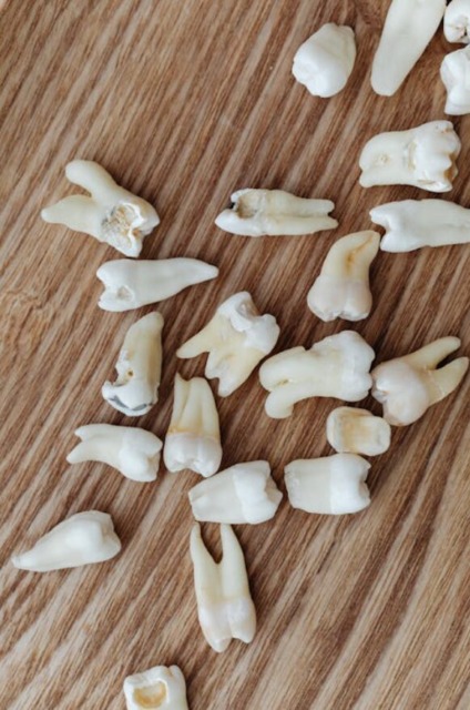 Implantat je potreben zaradi nadomestitve zob.