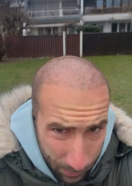 Finalist zadnje Kmetije se je javil po operaciji – sooča se z zelo neprijetno težavo (FOTO in VIDEO)