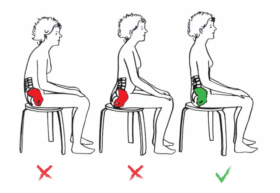 za preprečevanje vnetja živca je pomembna pravilna drža in gibanje