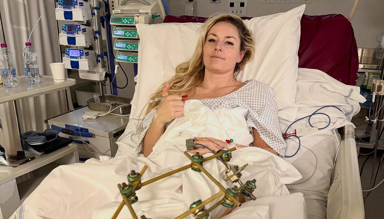 Lindsey Vonn se po hudem padcu javlja iz bolnišnice, je to konec njene kariere?