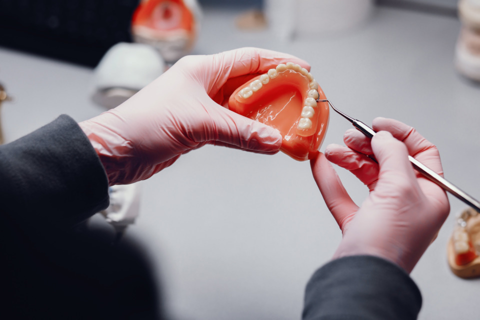 Zobni implantati, za stabilizacijo proteze