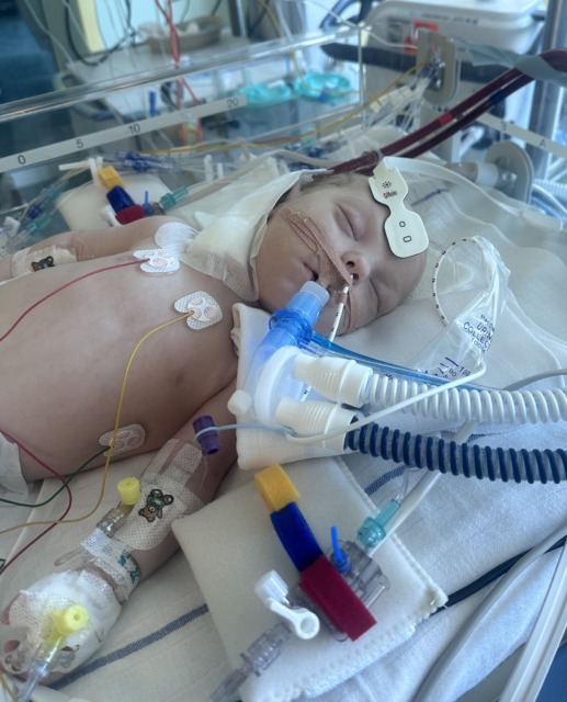 3-mesečni Oliver se bori za življenje, trenutno je na zahtevni 7-urni operaciji v Nemčiji Vir: Društvo Viljem Julijan