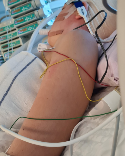 Pri komaj 13 letih je Ana slišala diagnozo, ki je spremenila vse, mami pa rekla le dve besedi: »Zmogli bova«