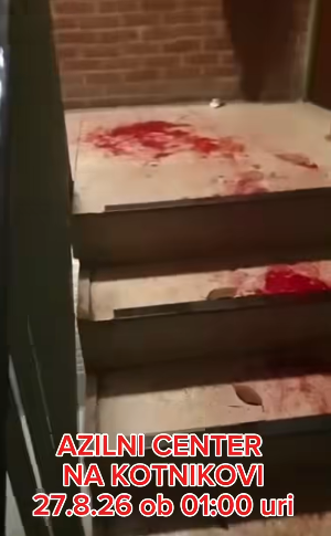 Zgodil se je krvav incident v azilnem domu na Kotnikovi – Zakaj je zgodba ostala skrita pred javnostjo? (FOTO)