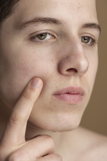 Retinol uporaba zaradi suhe kože